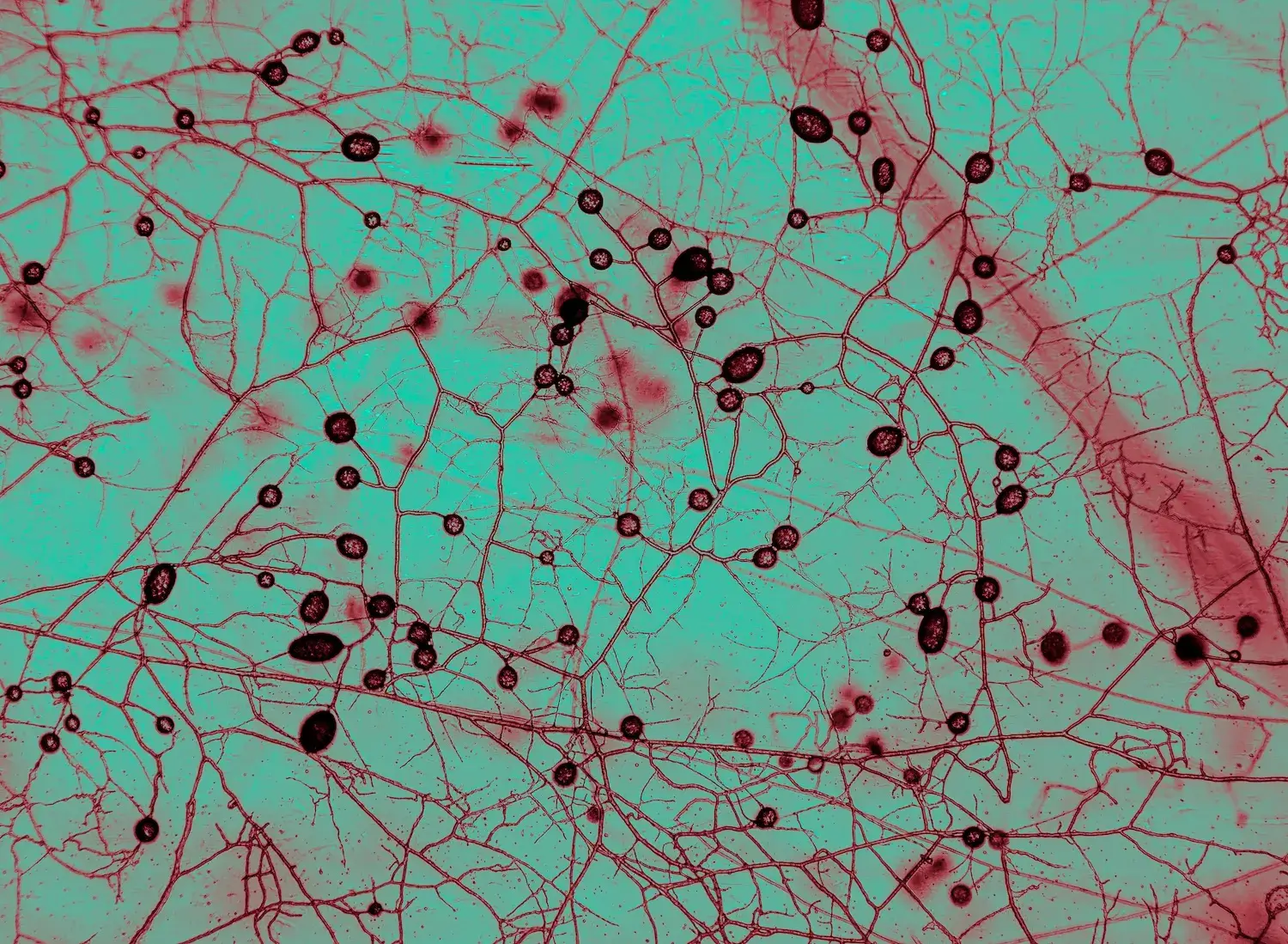 Mycorrizhal fungi seen from Morrison microscope at at AMOLF Institue of Complex Materials, Amsterdam. September 12, 2025. The circular structures are spores. The original photo is black and white, color is altered for legibility. Photo/Tomas Munita
